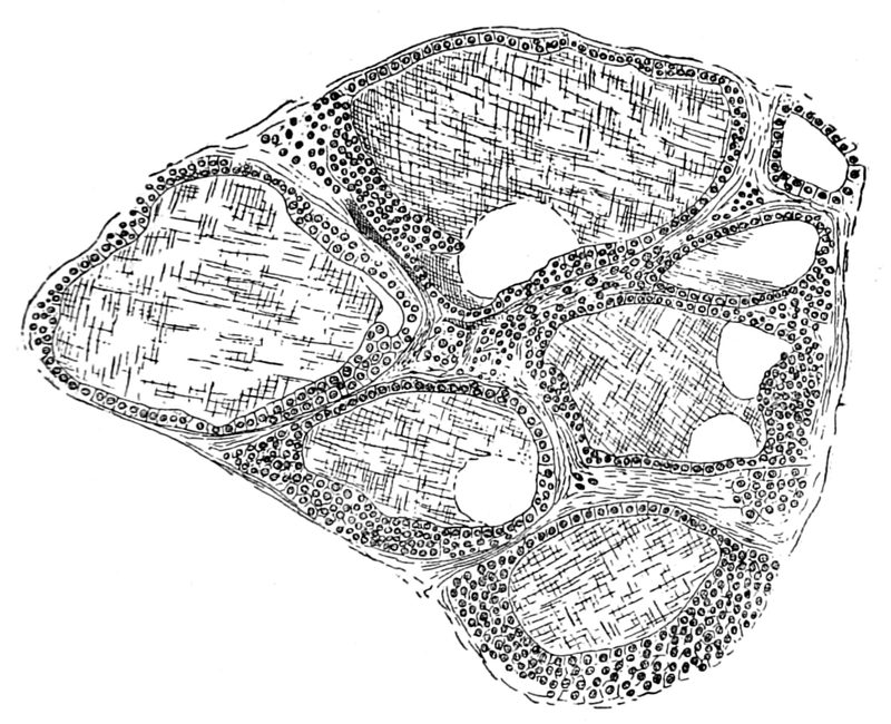 George Murray's drawing of a normal thyroid gland under the microscope