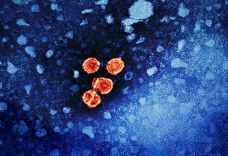 Colorized electron micrograph of hepatitis B virus particles