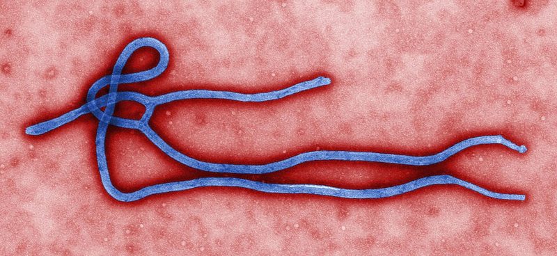Colorized electron micrograph of an Ebola virus particle