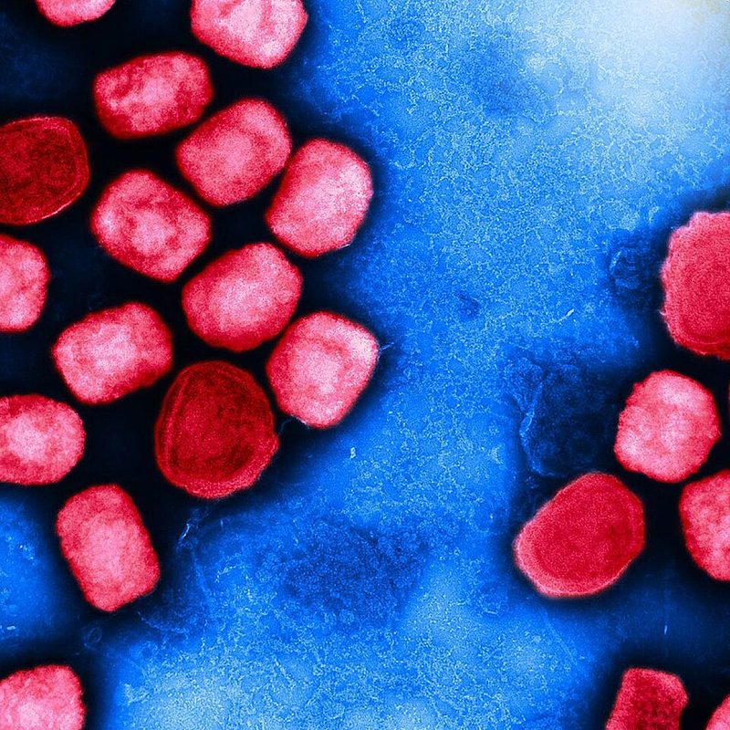 Colorized electron micrograph of mpox virus particles