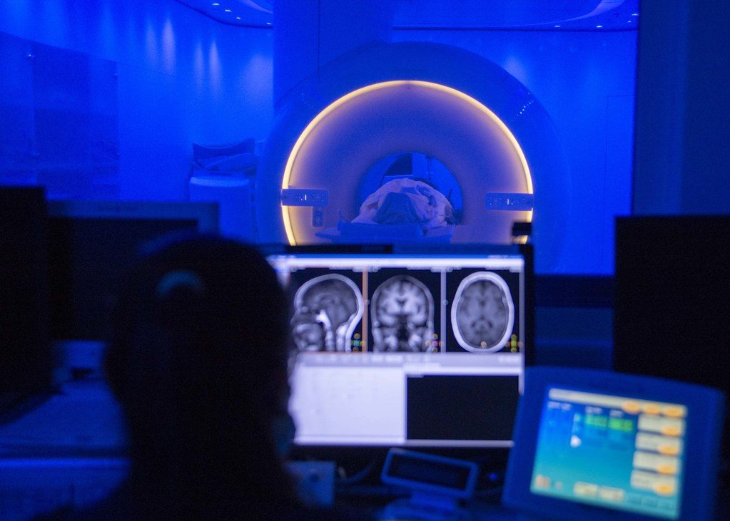 Brain scan images on monitors in an MRI control room