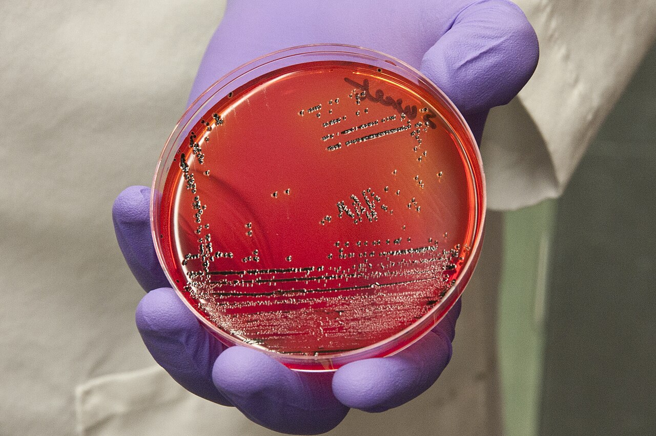 A gloved hand holding a petri dish with a bacterial culture