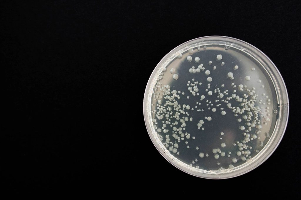 Bacterial colonies growing in a petri dish